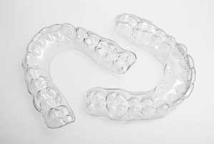 Invisalign Lockport IL