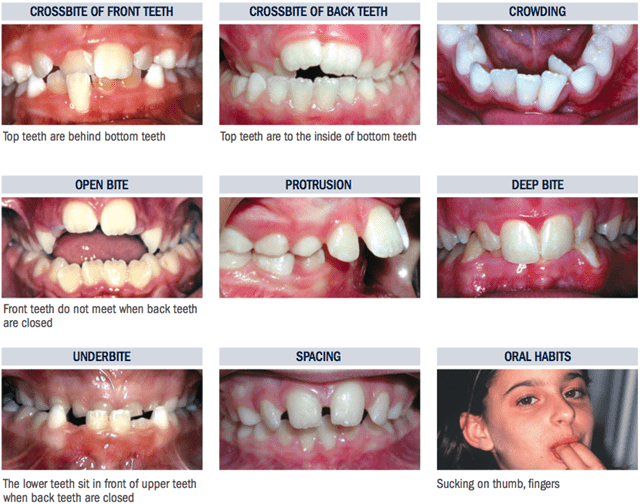 Orthodontic Treatments Homer Glen