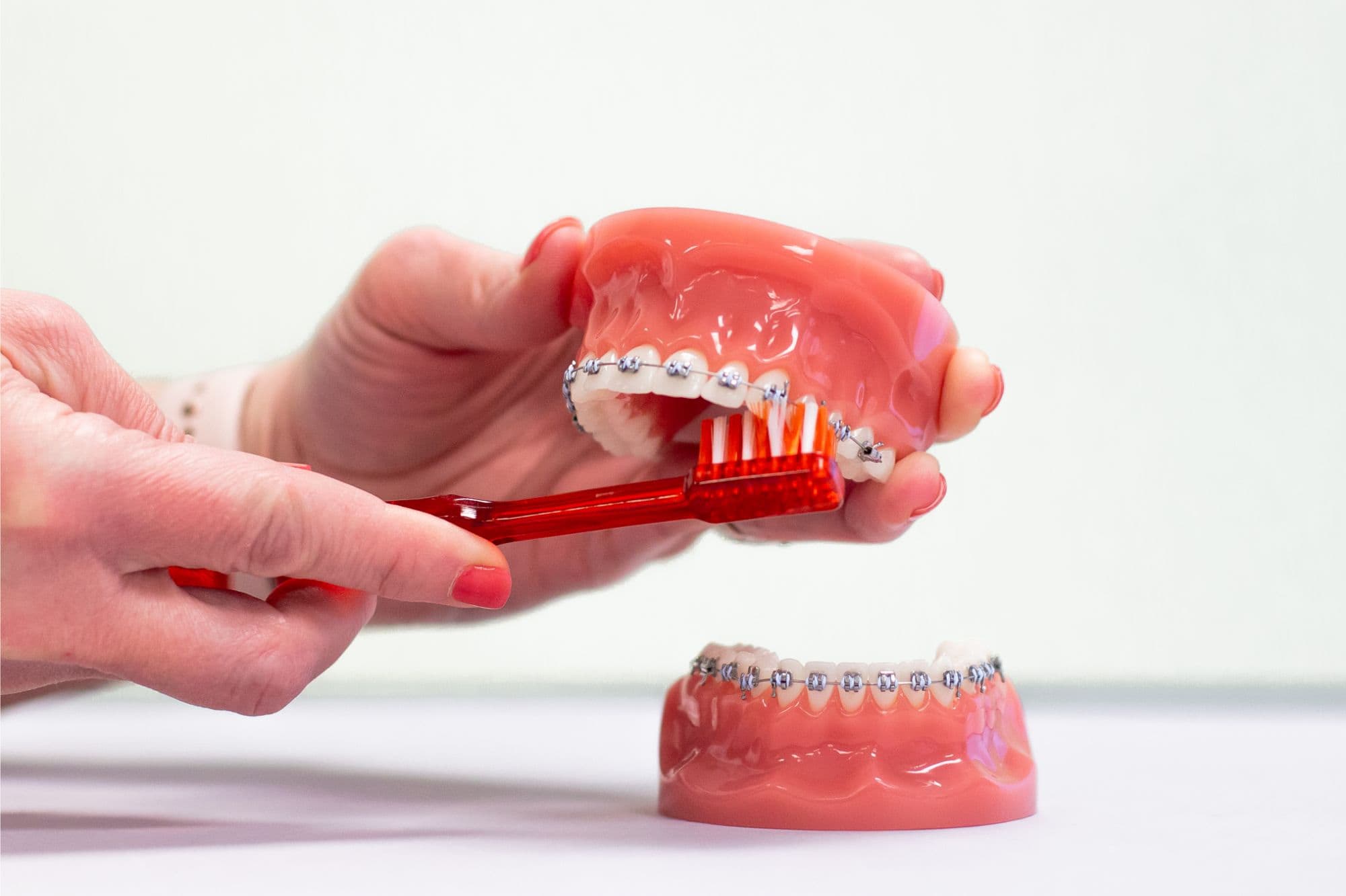 IMG_5924 Orthodontics Lockport