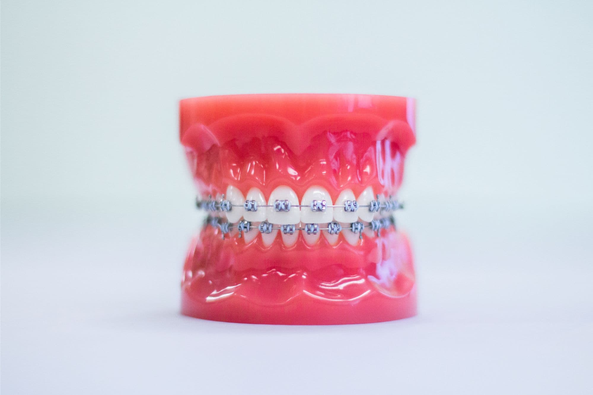 Orthodontist in Orland Park IL